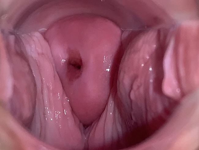 LolaLalka - examen du col de l'utérus. Qu'est-ce qui ne va pas avec mon vagin ?